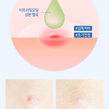 Review Miếng dán trị mụn Dr. Belmeur Clarifying Spot Soothing Patches The Face Shop