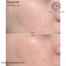 Review Tinh chất thuần chay chống lão hóa The Therapy Vegan Blending Serum 50ml The Face Shop